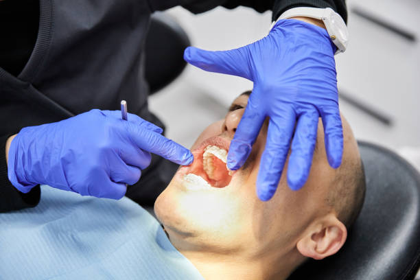 Best Emergency Treatment for Dental Infections or Abscesses in Wilberforce, OH